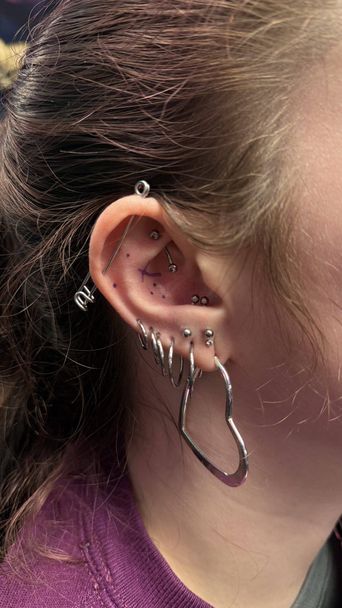Healed ear with multiple titanium hoops and a fine helix piece, placement built around the client's anatomy